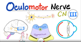 动眼神经 - 第三对脑神经（CN III） - 颞叶疝（Uncal herniation）